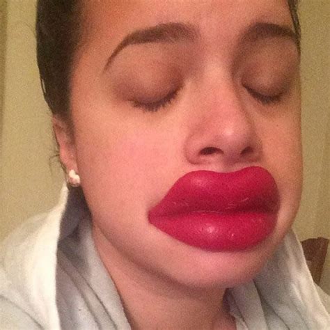 Reasons Why You Shouldnt Try The Kylie Jenner Lip Challenge
