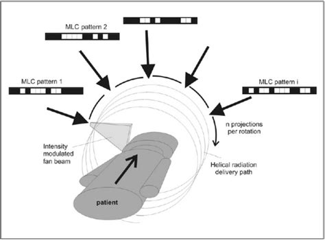 Illustration Of The Helical Tomotherapy Delivery Download Scientific