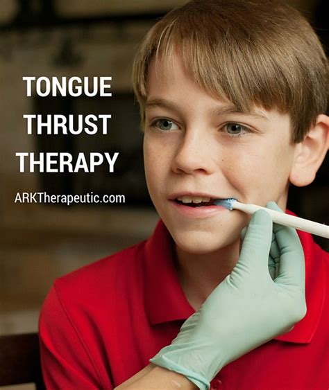 how to stop tongue thrusting teeth 36 tongue thrust correction ideas tongue thrust