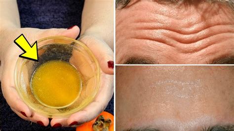 Homemade Remedy To Get Rid Of Deep Forehead Wrinkles Naturally From