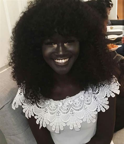 Girl Was Bullied For Her Incredibly Dark Skin Now She Became A Model