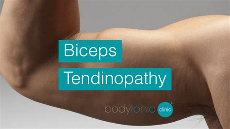 What Is Biceps Tendinopathy Symptoms Casuses Treatments And Prevention