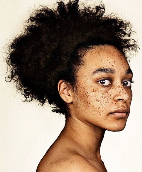 Brock Elbanks Freckles Shows Off The True Beauty Of Having Freckles