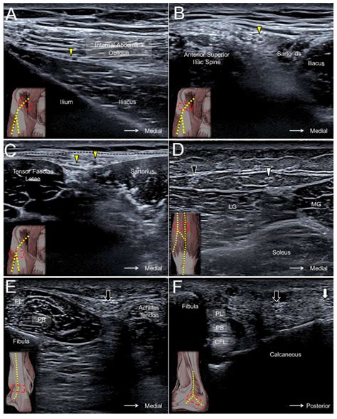 Jcm Free Full Text Ultrasound Imaging For The Cutaneous Nerves Of