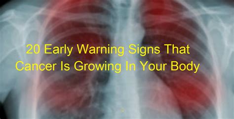 20 Early Warning Signs That Cancer Is Growing In Your Body The Wisdom