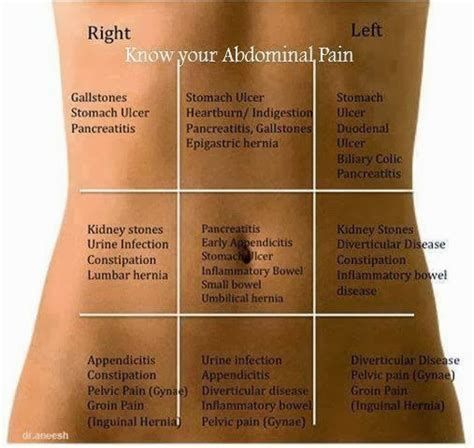 Inspirational Musings Know Your Abdominal Pain