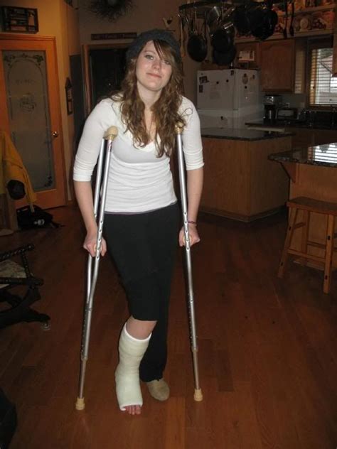 Broken Foot Cast Sock Leg Cast Crutches Beatnik Short Legs Lady