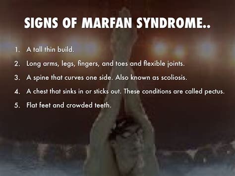 Marfan Syndrome By Jacob Davis