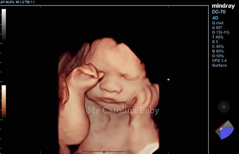Premier Combo Ultrasound Package My Carolina Baby