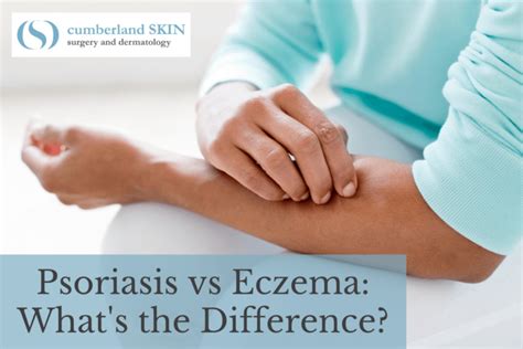 Psoriasis Vs Eczema Whats The Difference And How Do They Compare
