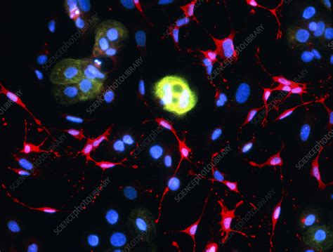Immunofluorescent Lm Of Neuroblastoma Cancer Cells Stock Image M132