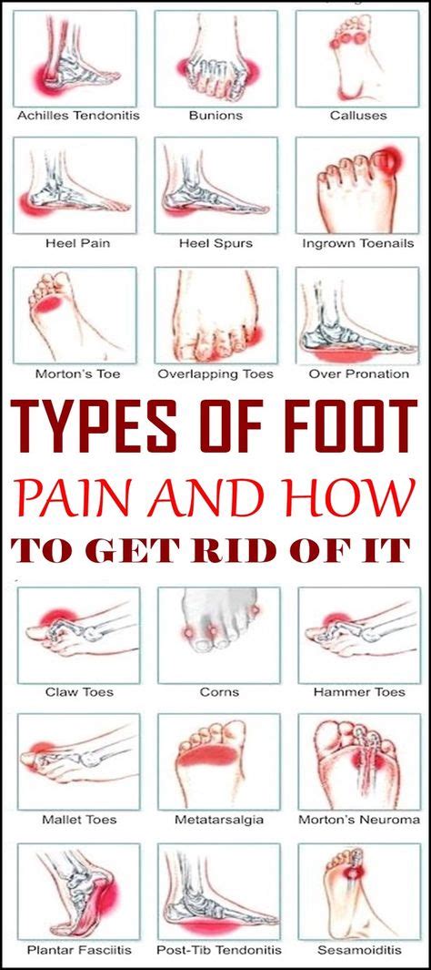 The 25 Best Foot Pain Chart Ideas On Pinterest