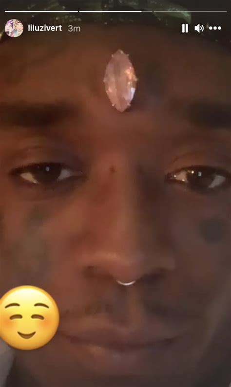 Lil Uzi Vert Appears To Have Pierced An Enormous Diamond Into His