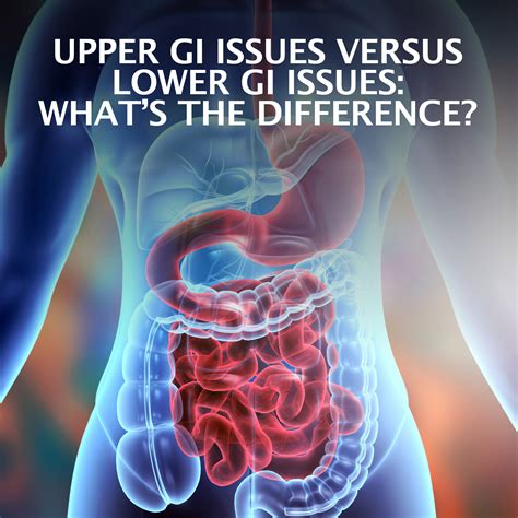 Whats The Difference In Upper Gi Issues Versus Lower Gi Issues