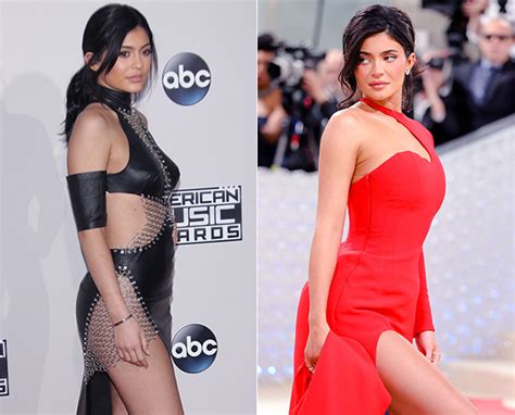 Kylie Jenner Had Boob Job At She Confirms On Kardashians