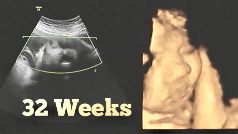 Ultrasound At 32 Week Pregnant 8 Months Pregnancy Growth Scan Youtube