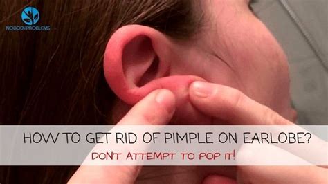 how to get rid of pimple on earlobe don t attempt to pop it how to get rid of pimples