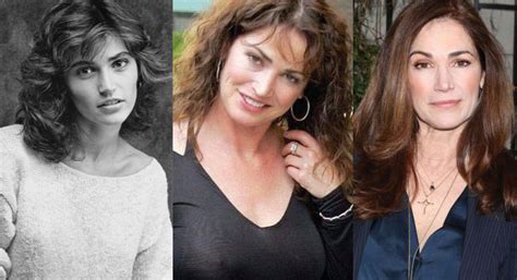 Kim Delaney Plastic Surgery Before And After Pictures 2024