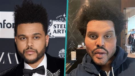 The Weeknd Shocks Fans With Drastically Different Looking Face Access