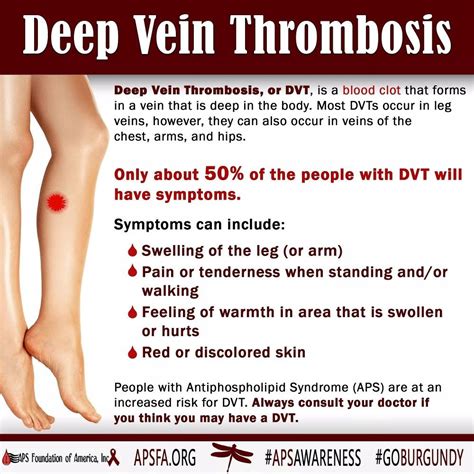 Deep Vein Thrombosis Dvt Treatment And Symptoms Artofit