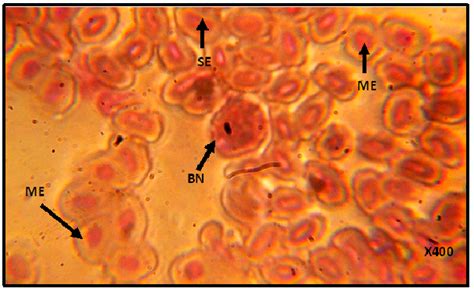 Blood Smear Of Control Fish Showing Senile Erythrocyte SE Mature Download Scientific Diagram