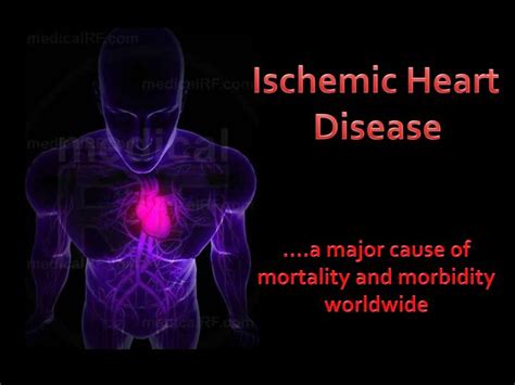 Ppt Ischemic Heart Disease Powerpoint Presentation Free Download