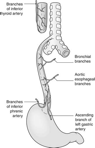Esophageal Atresia And Tracheoesophageal Fistula Obgyn Key