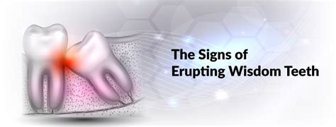 The Signs Of Erupting Wisdom Teeth Harbour Pointe