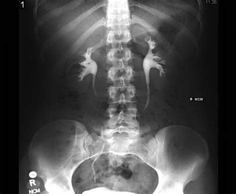 Fitur canggih yang dikembangkan oleh google ini selalu menyajikan terjemahan yang kredibel dan cukup bisa dipercaya. INDIKASI PEMERIKSAAN IVP PDF