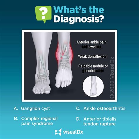 Anterior Ankle Pain And Gait Disturbance Lets Diagnose