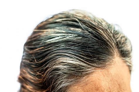 Premature Gray Hair All Things You Need To Know Cool Mens Hair