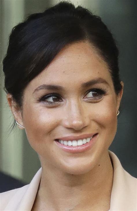 Meghan Markle Women Request Nose Freckle Treatment To Look Like Royal Daily Telegraph