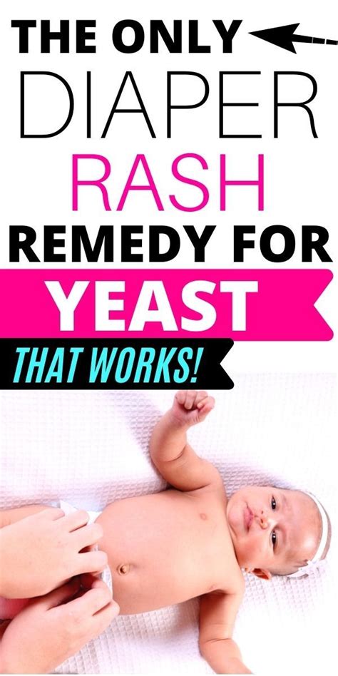 Yeast Diaper Rash Home Remedy In 2021 Diaper