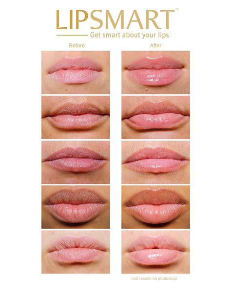 Lipsmart Powerful Hydration For Healthier Lipplumpers Anti Aging