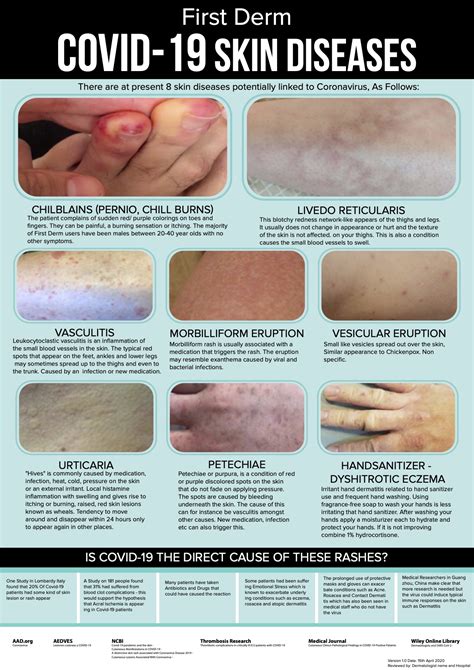 Can You Really See Coronavirus On The Skin Online Dermatology