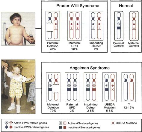 beautiful work info about how to detect angelman syndrome spellquestion
