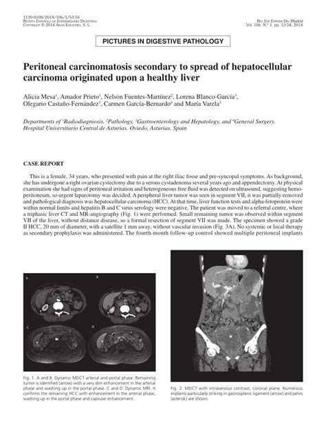 Pdf Peritoneal Carcinomatosis Secondary To Spread Of Hepatocellular