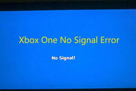 Fix The Xbox One No Signal Error With Top 4 Solutions Minitool