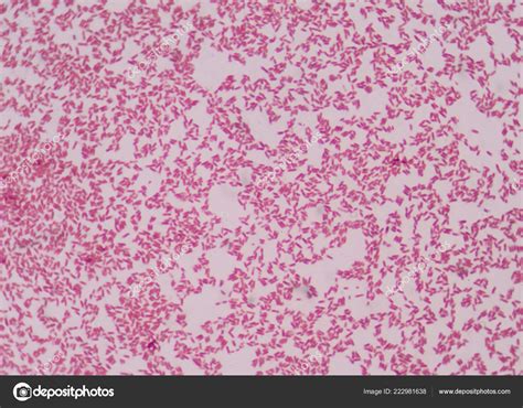 Gram Staining Also Called Grams Method Method Differentiating