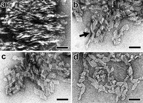 Tem Micrographs Of Negatively Stained Waxy Maize Starch Samples Ac
