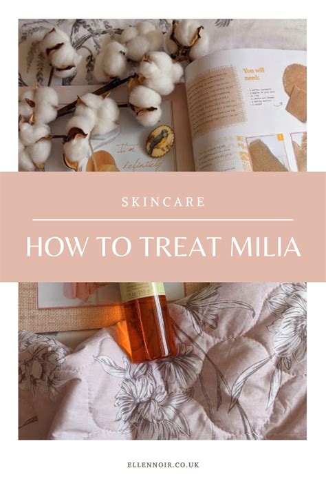 How To Treat Milia Skin Care Treats Tips