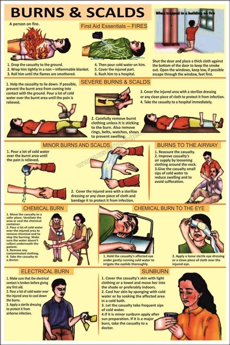 Electric Shock And Its Management Electric Shock Treatment Chart