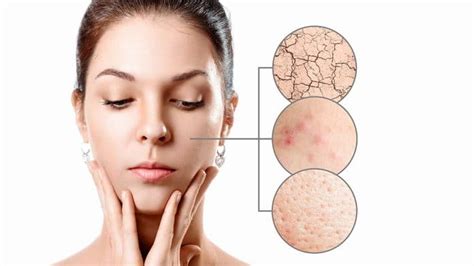 Top 10 Tips To Treat Dry Skin Doctor Asky