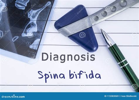 Diagnosis Of Spina Bifida Medical Health History Written With