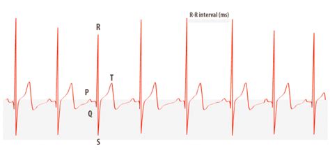 What Is Heart Rate Variability Hrv And Why Does It Matter Firstbeat Blog
