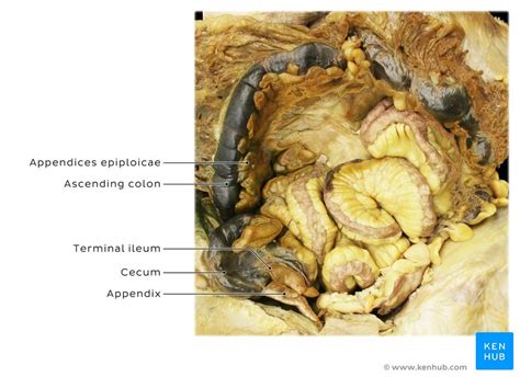Cecum And Vermiform Appendix Anatomy And Function Kenhub