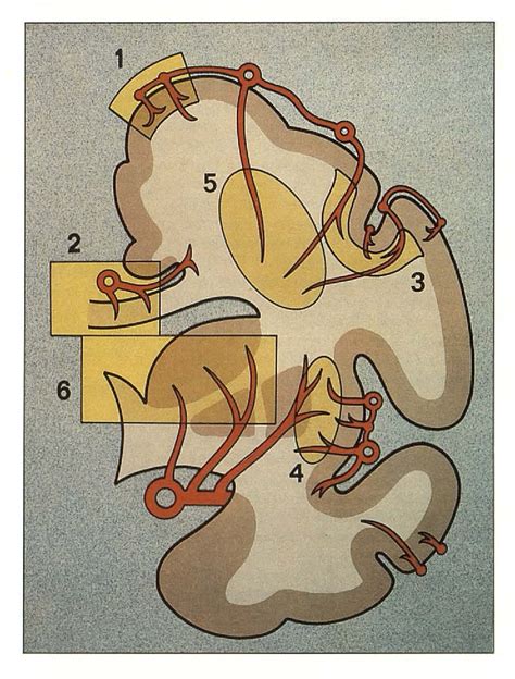 Figure 1 From Features Of The Cerebral Vascular Pattern That Predict