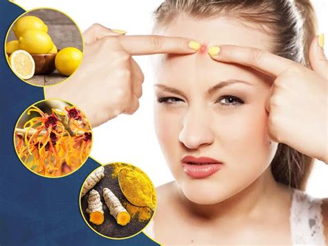 5 Effective Natural Remedies To Cure Sebaceous Cysts Onlymyhealth