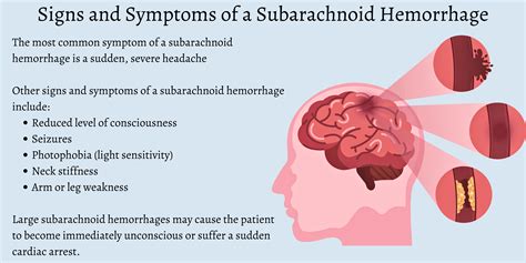 What Is Subarachnoid Hemorrhage Symptoms Causes And Prevention The