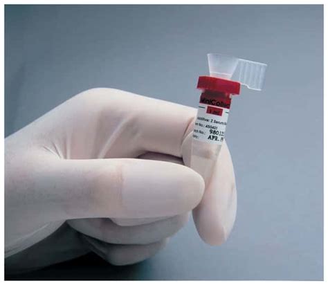 Greiner Bio One Minicollect Röhrchen Für Kapillar Blutentnahmesystem